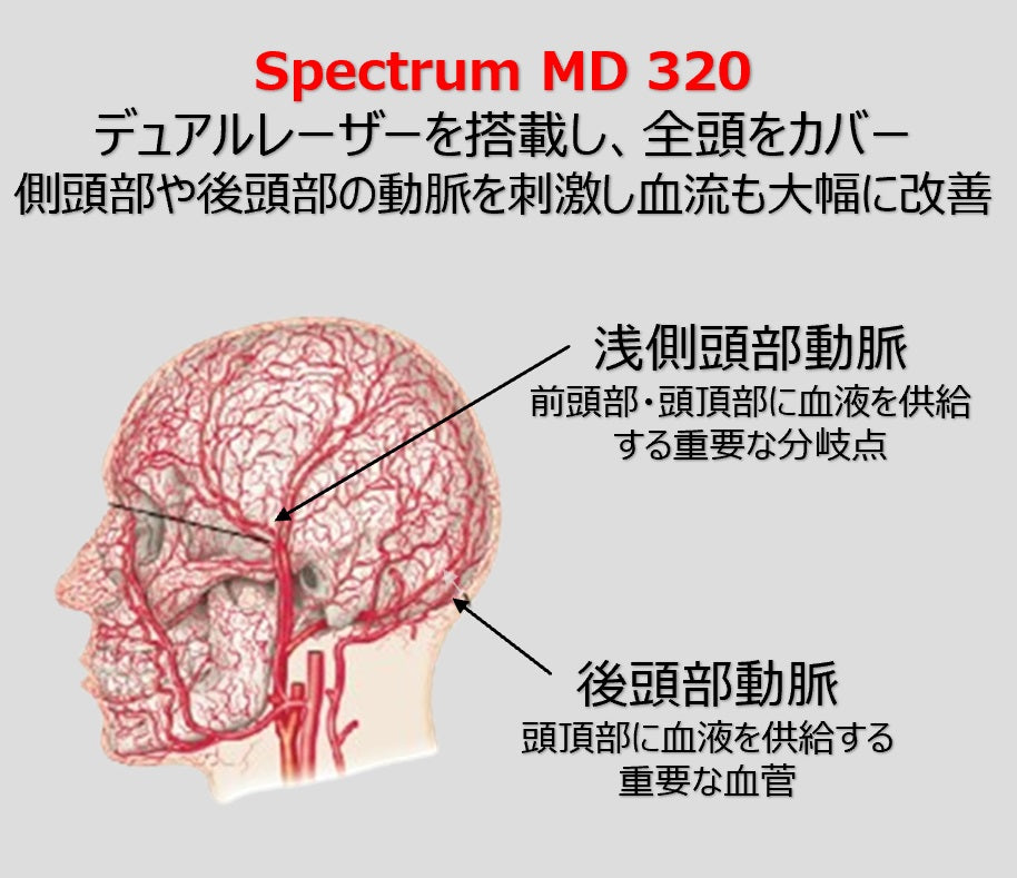 Capillus Spectrum MD 320 5年保証