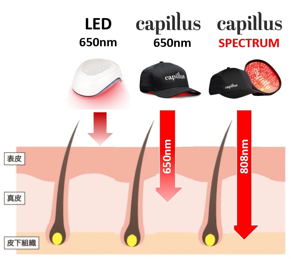 Capillus Japan 公式ストア|低出力レーザー育毛器|Capillus（カピラス）