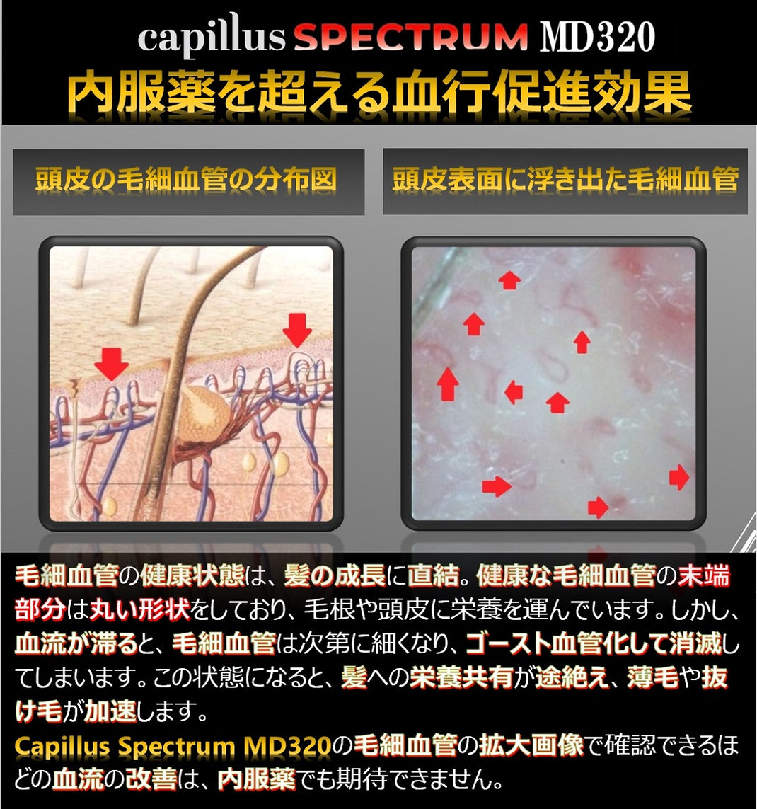 Capillus Spectrum Capillus Japan 公式ストア|低出力レーザー育毛器|Capillus(カピラス)